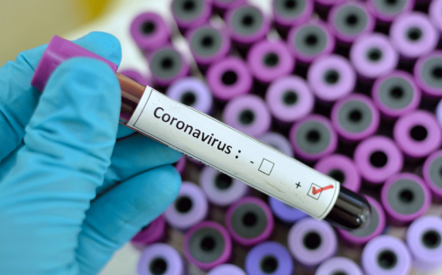 Azərbaycanda koronavirusa 595 yeni yoluxma qeydə alınıb, 12 nəfər vəfat edib